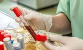  Hemoqlobinin səviyyəsini normalda necə saxlayaq?  