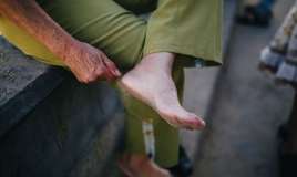 50, 60 və ya 70 yaşlada yaranan    xərçəng ayaqlarda görünür