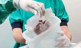 Böyrək orqanı gözləyənlərin sayı    1000-i keçib