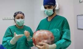 Qadının qarnından 9 kiloqramlıq şiş çıxarıldı -  FOTO