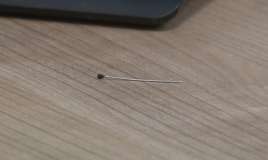 2 yaşlı uşağın bağırsağında iynə tapıldı -  FOTO