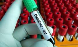 Xolesterol haqqında gözardı olunmamalı  – 4 əsas fakt