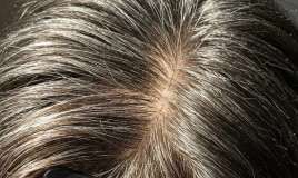 Saçlarımız bizi xərçəngdən qorumaq üçün ağarırmış 