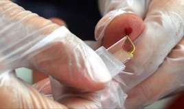 Yeni qan qrupu yaradılır:  Yalnız 50 nəfərdə var