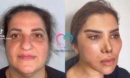 60 yaşlı qadının dəyişimi müzakirələrə səbəb oldu -  VİDEO