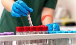 Bu ucuz analizi hamı versin, xərçəng riskini göstərir -  Kardioloqdan