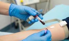 Bu ucuz analizi hamı versin, xərçəng riskini göstərir -  Kardioloqdan