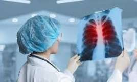 Son 20 ilin dəhşəti  – Vərəm qlobal miqyasda oyanır