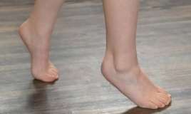 Uşaqların barmaq ucunda gəzməməai üçün bunları edin -  VİDEO