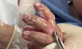 10 aylıq körpə yanıq xəsarəti aldı -  Əlini qaynar çaydana salıb... - VİDEO