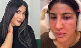 Reklam etdiyi pilinq  Ləmanın üzünü yandırdı