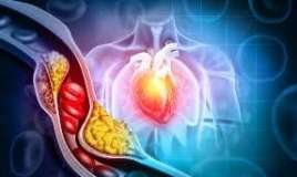   Qəfil ürək ölümü riski yüksək  insanlar   kimlərdir?