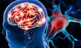  Meteohəssaslığa yozmayın  – Bu əlamət insultdan öncə ola bilər