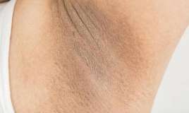 Qolaltı qaralmalar -  Necə xilas ola bilərik? - Həkimdən açıqlama