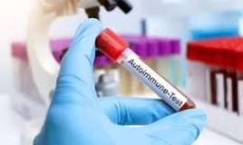 Azərbaycanın ilk autoimmun laboratoriyası  hardadır? 