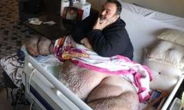 48 yaşlı kişi 300 kiloqrama çatdı:  5 ildir çölə çıxmır-FOTO