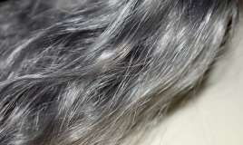  Vaxtından əvvəl saçların ağarması  – Bərpa etmək olarmı?