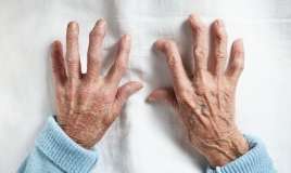  Revmatoid artritin ən erkən  – 7 ƏLAMƏTİ