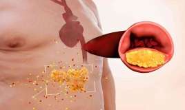  Kimlərdə daxili orqanlar piylənir?  – Diqqət