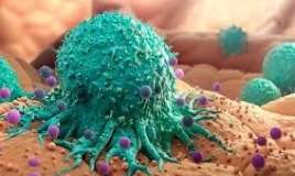 Onkologiyanın müalicəsində effektiv ikili 