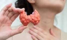 Dırnaqlarda qalxanvari vəz xəstəliyinin əlaməti 