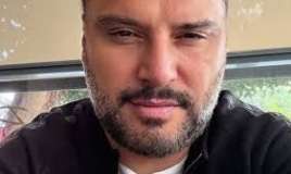 50 yaşında üzünə botoks etdirdi 