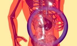 Şəkər xəstəliyinin səbəbi mikroblar ola bilər 