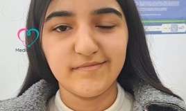 İnfluenza virusu yeniyetmənin üzünü iflic etdi -  VİDEO