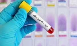 Vitamin D 100 olarsa heç bir xəstəlik tapmazsınız -  Kardioloq