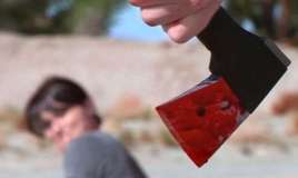 Əmisi tərəfindən baltalanan azyaşlının vəziyyəti açıqlandı 