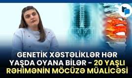 16 yaşına kimi sağlam uşaqda ayaq tutulmasının ilginc sirri -  VİDEO