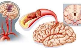Sinir sisteminin düzgün işləmədiyinin    əsas əlamətləri