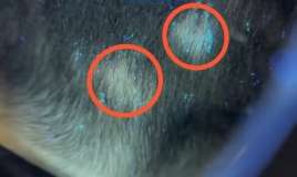 Küçə pişiyi ilə oynayan uşağın saçı töküldü -  Dəri göbələyi yarandı-VİDEO