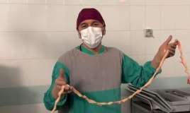 Qadından çıxarılan miomanın ölçüsü hər kəsi təəccübləndirdi -  VİDEO