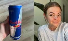 2 həftə energetik içki içən qadının  -  qaraciyəri zədələndi