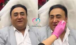 Elgiz üzünə estetik prosedurlar etdirdi -  VİDEO