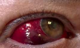 Qadının gözü zədələndi -  Dəhşətli hala düşdü - VİDEO