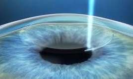 Bu nevroloji xəstəliyin ilk əlaməti    gözlərdən başlayır