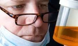 Mədəaltı vəz xərçənginin sidikdə görünən   əlaməti