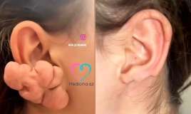 Sırğadan sonra qulağı bu hala düşdü -  VİDEO