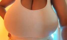 10 kiloqramlıq süd vəziləri olan qadın    əməliyyat olundu