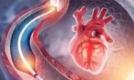 Ürək damarlarının tutulduğunu göstərən    8 əsas əlamət