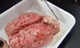 Beyində qurd və parazitlər  - Əlamətlər