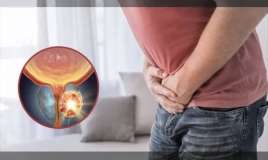 Xərçəng kişilərdə  sonsuzluğa səbəb ola bilərmi?