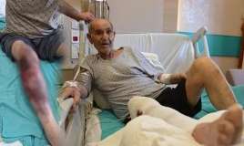 Təmizləyicisi vasitə ayağını yandırdı -  Xəstəxanalıq oldu-FOTO