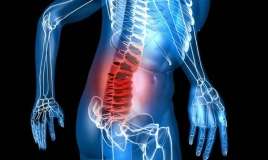 Çox yuxululuq və ağrılar mielomanın əlaməti  ola bilər