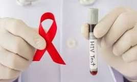 Azərbaycanda neçə HİİV xəstəsi var? 