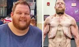 163 kilo arıqladı -  Görənləri şok etdi