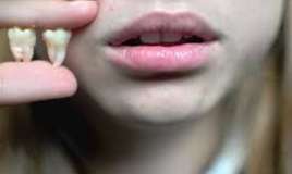 Ağıl dişi ilə insanın “ağlı” arasında əlaqə varmı? 