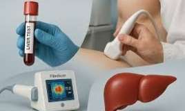 Qaraciyər sirrozu: hansı analiz və müayinələr vacibdir? 